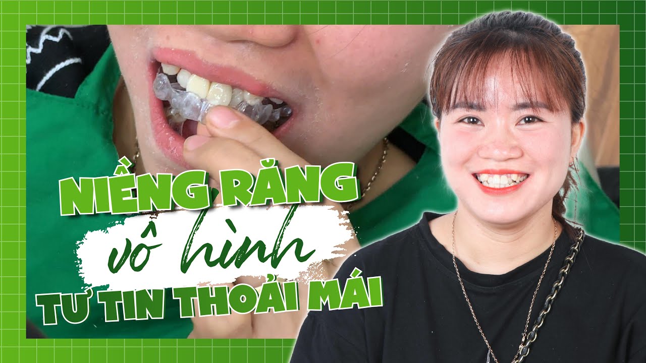 Niềng răng trong suốt Invisalign Thái Nguyên có tốt không?