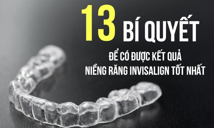 13 bí quyết giúp trải nghiệm phương pháp niềng răng invisalign có kết quả tốt nhất