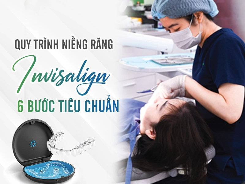 Quy trình niềng răng invisalign 6 bước tiêu chuẩn