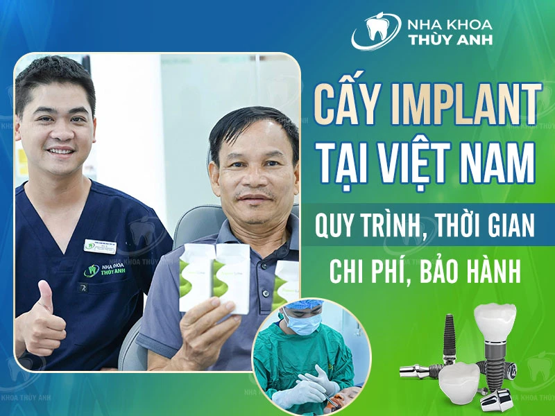 Cấy implant tại Việt Nam – Quy trình, thời gian, chi phí, bảo hành
