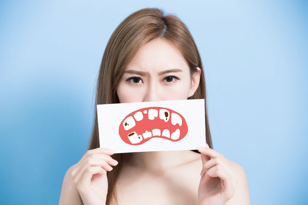 Đặt khuôn trám hoặc dùng chỉ co nướu là bước nào trong quy trình hàn răng?
