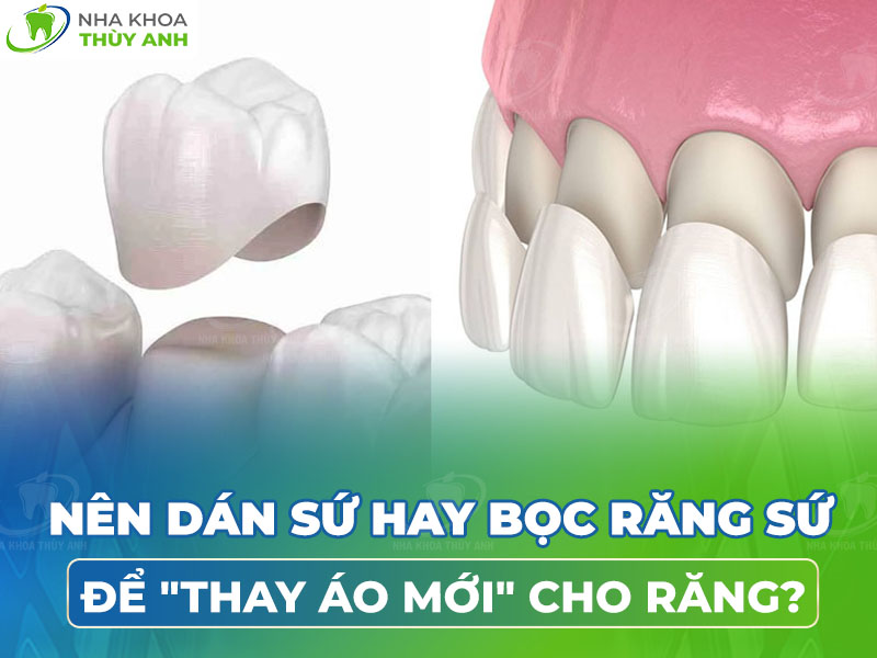 Nên dán răng sứ hay bọc răng sứ để “thay áo mới” cho răng?