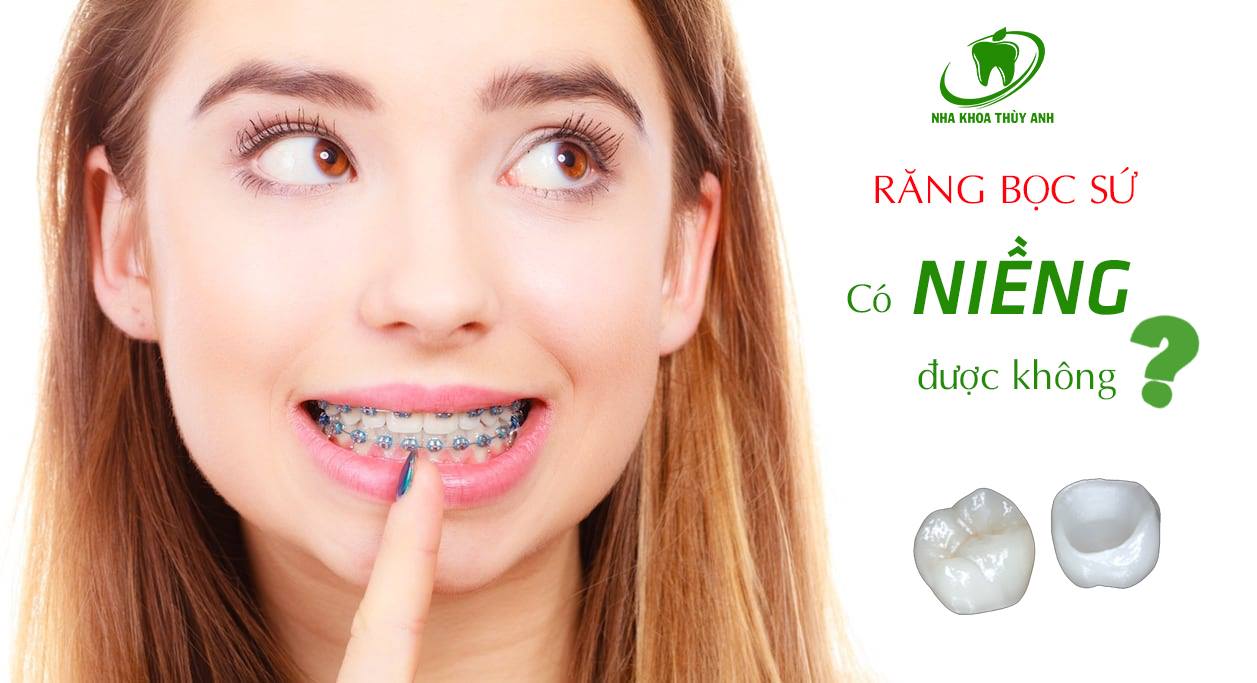 Có những trường hợp nào có thể niềng răng khi đã trồng răng sứ?

