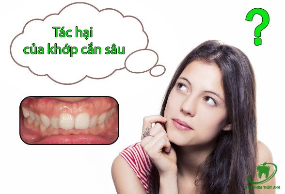 Hậu Quả Khớp Cắn Sâu – Chẩn đoán cắn sâu dựa vào những yếu tố nào?