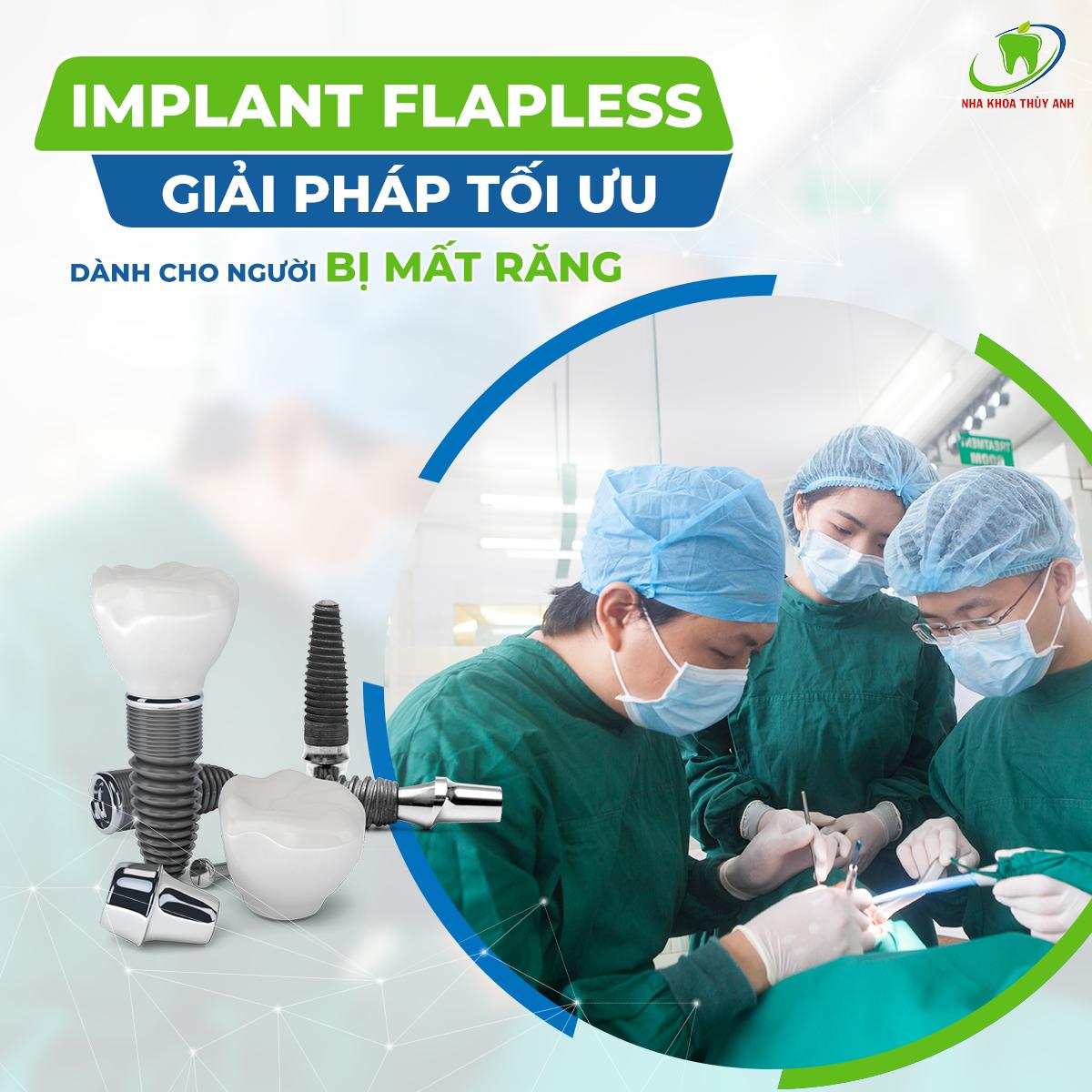 thoi-gian-ton-tai-rang-implant-3