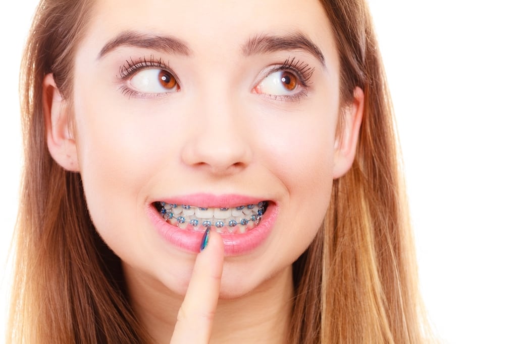 Độ tuổi nào được coi là quá muộn để niềng răng?
