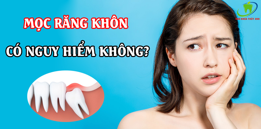 Mọc răng khôn có nguy hiểm không? Các biểu hiện có thể gặp khi mọc răng khôn.