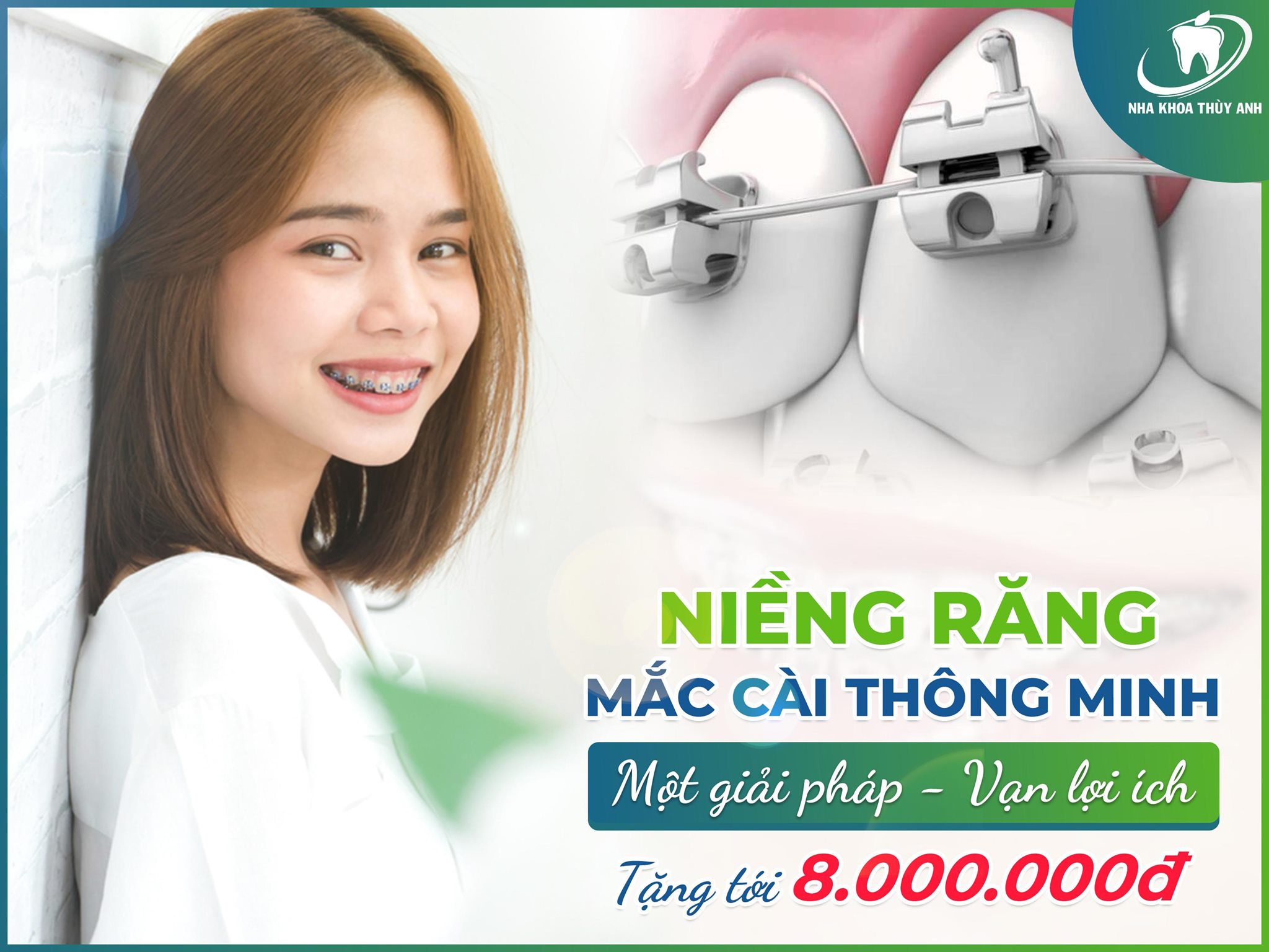 Cách niềng răng mắc cài thông minh hoạt động như thế nào?