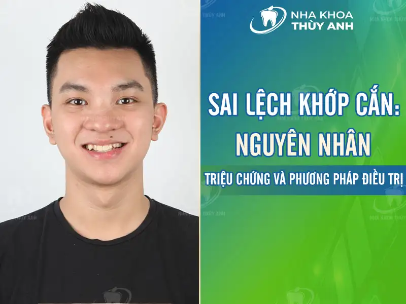 Lệch khớp cắn: Nguyên nhân, triệu chứng và cách điều trị