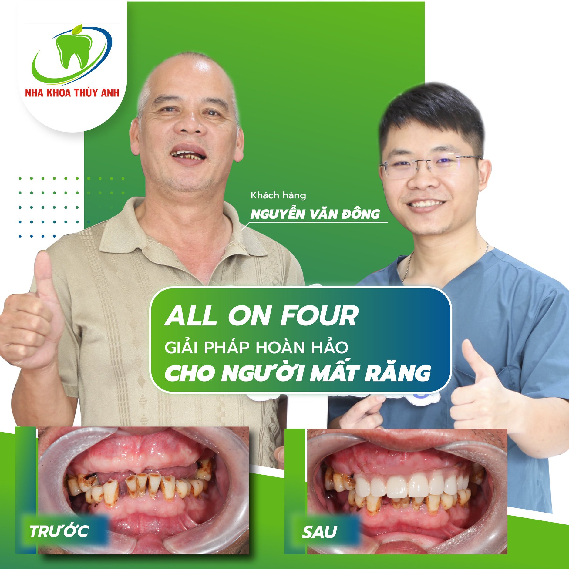 dia-chi-trong-rang-implant-khu-vuc-dong-da-3