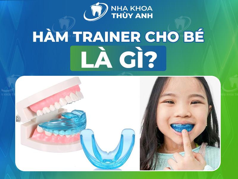 Hàm trainer cho bé là gì? Niềng răng trainer cho trẻ em có hiệu quả không?