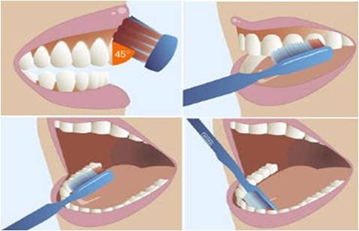 Hướng dẫn cách vệ sinh răng đúng và chuẩn – Nha Khoa Thùy Anh