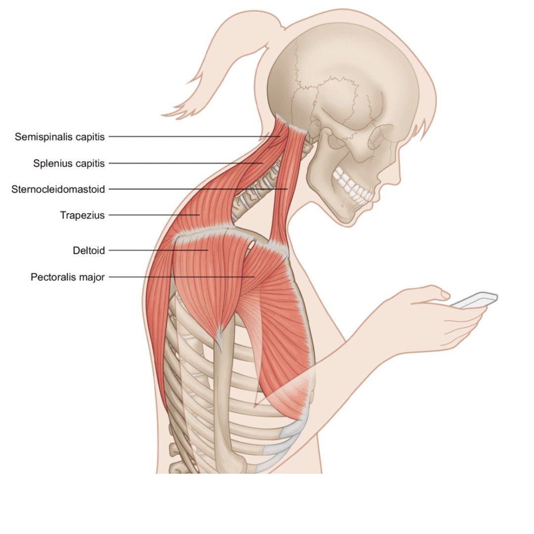 Hướng dẫn tập Chin Tucking – điều chỉnh rối loạn tư thế cổ gáy