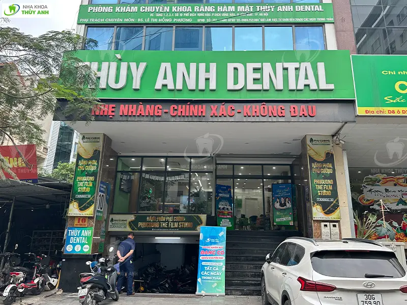 Mách bạn địa chỉ niềng răng mắc cài và invisalign uy tín tại nha khoa Cầu Giấy