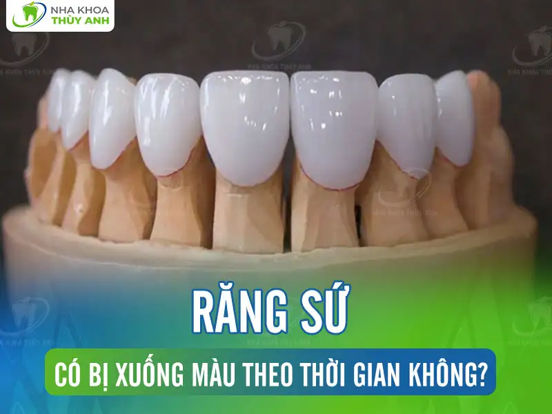 Răng sứ có bị xuống màu theo thời gian không?