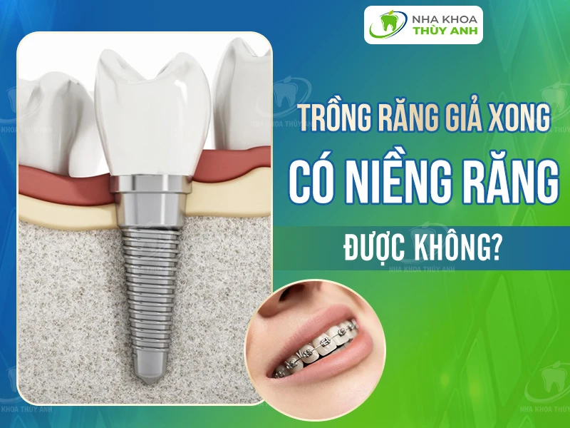 Trồng răng giả xong có niềng răng được không?