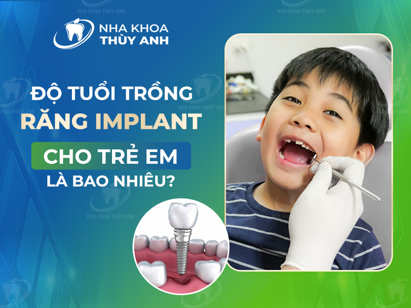 Độ tuổi trồng răng implant cho trẻ em là bao nhiêu? Nha khoa Thùy Anh