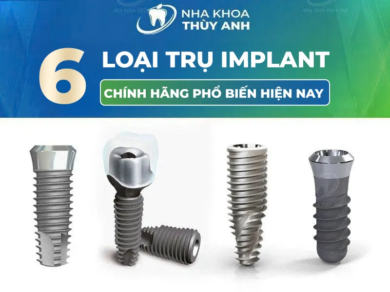 6 các loại trụ Implant chính hãng phổ biến hiện nay