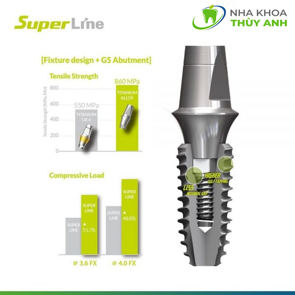 tru-implant-superline-1