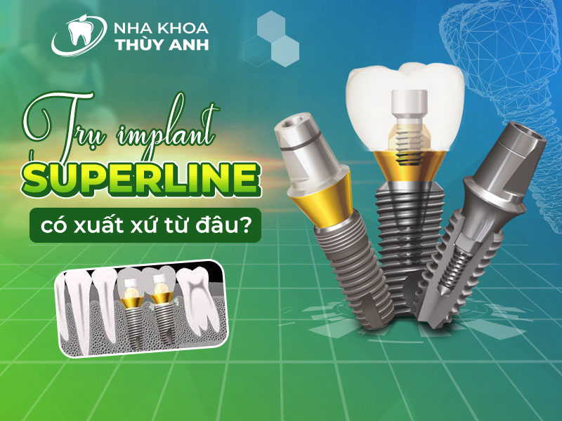 Trụ implant Superline có xuất xứ từ đâu? Chất lượng thế nào?