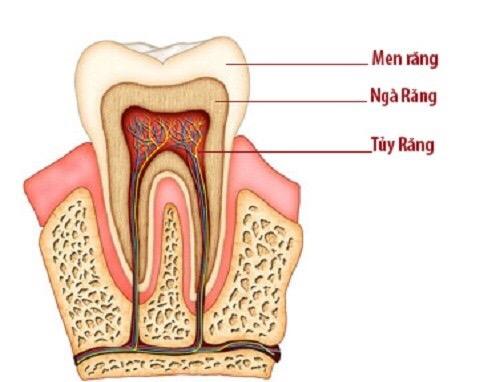 Quy trình hàn răng lấy tủy thực hiện như thế nào?