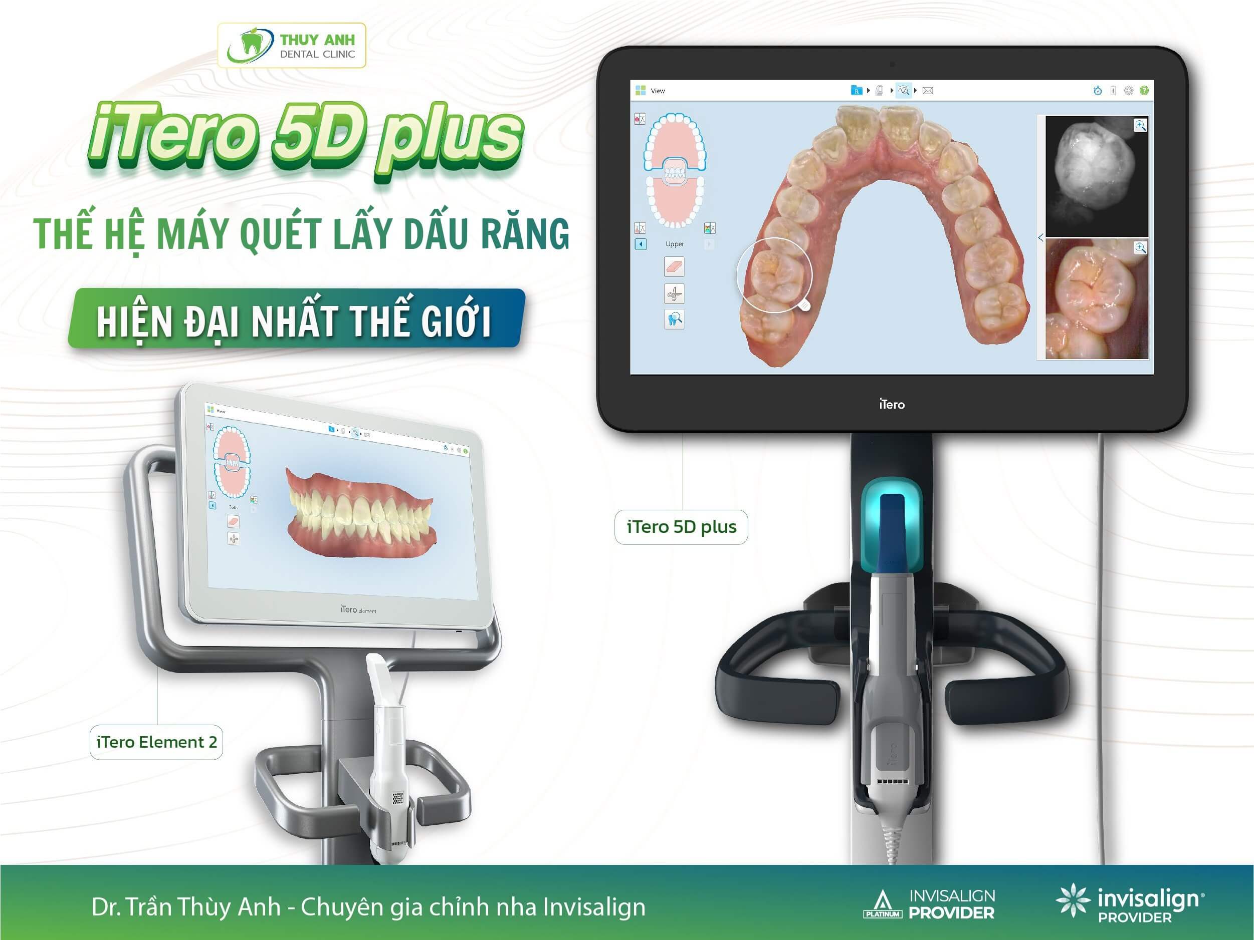 iTero 5D Plus thế hệ máy quét lấy dấu răng hiện đại nhất thế giới