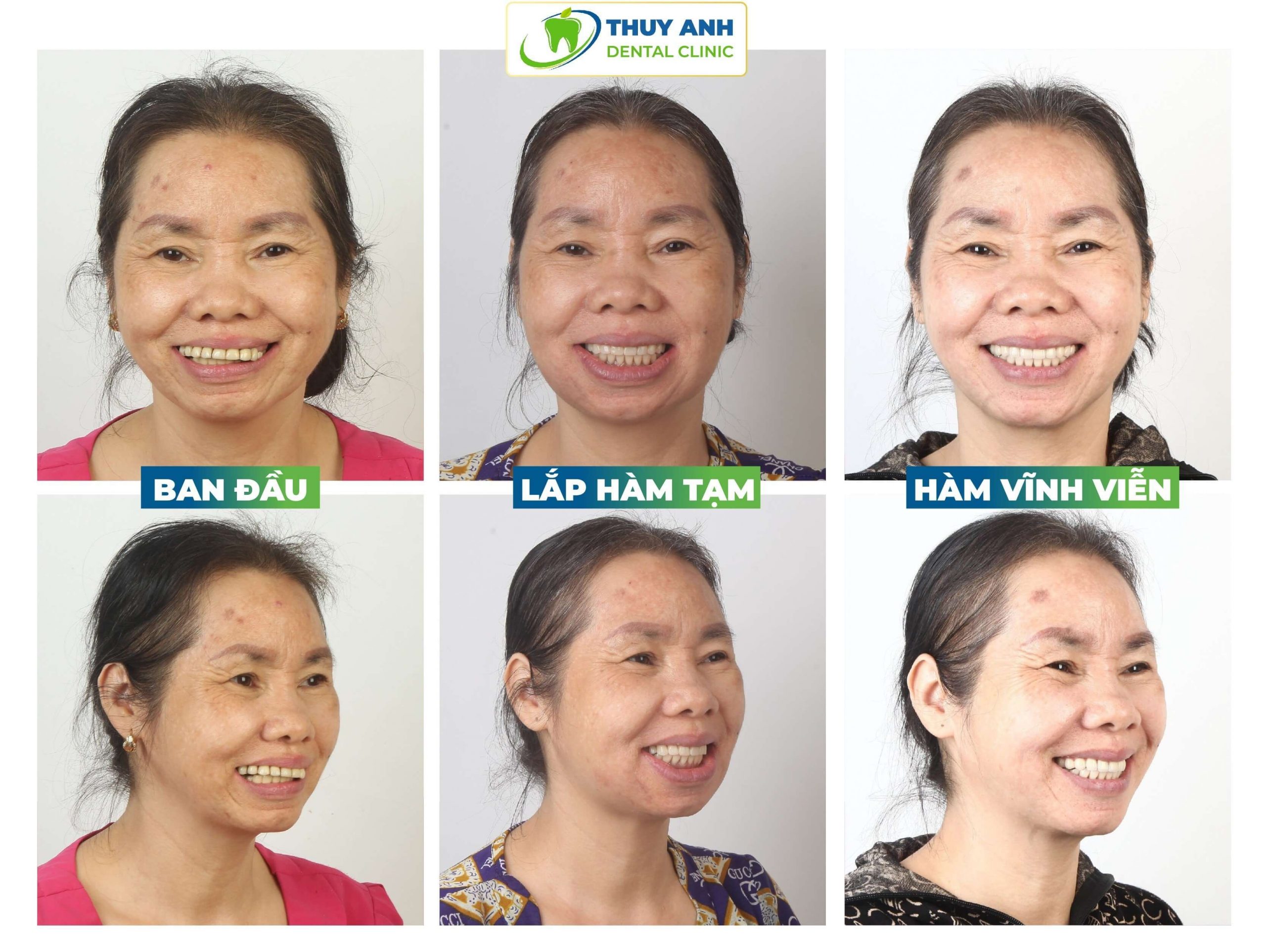 Cô Lâm Thị Hùng (58 tuổi)