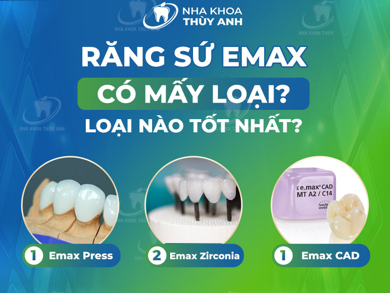 Răng sứ Emax có mấy loại? Loại nào tốt nhất? Nha khoa Thùy Anh