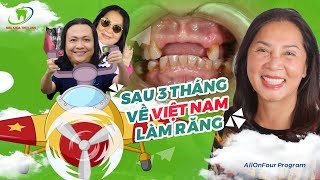 Hành Trình Dài Từ Đức Về Việt Nam Trồng Răng Toàn Hàm Của Cô Phượng Krug