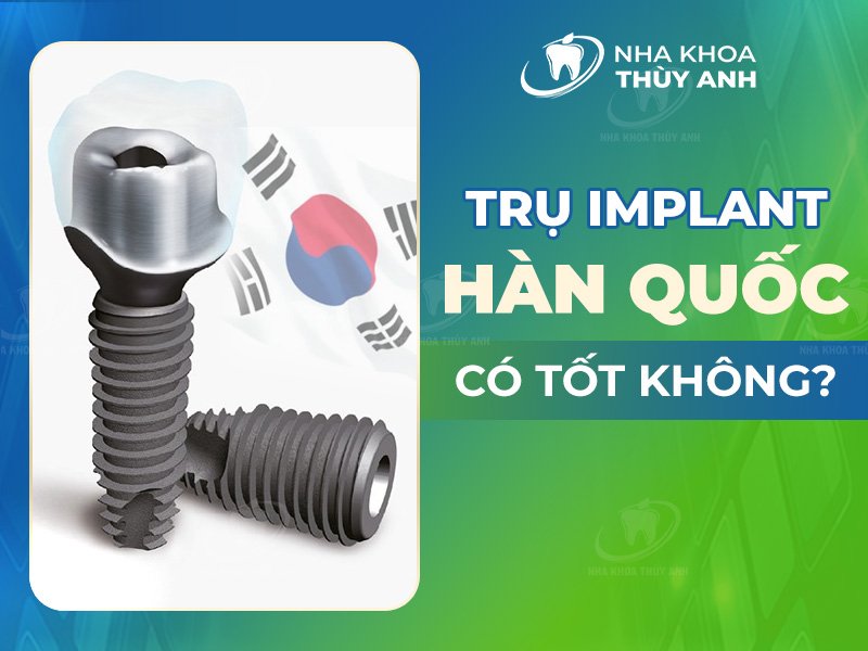 Trụ implant Hàn Quốc có tốt không?