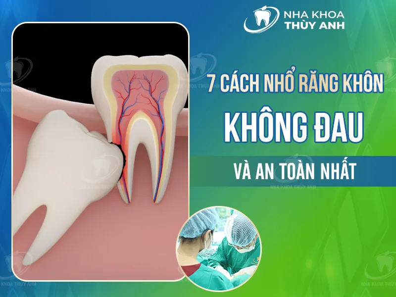 7 cách nhổ răng khôn không đau và an toàn nhất