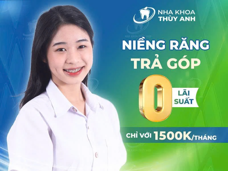 Giá niềng răng trả góp với “chi phí mềm” tại thủ đô Hà Nội