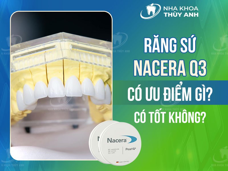 Răng sứ Nacera Q3 có ưu điểm gì? Có tốt không?
