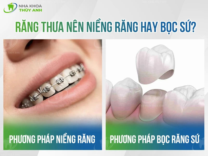 Răng thưa nên niềng răng hay bọc sứ tốt hơn?
