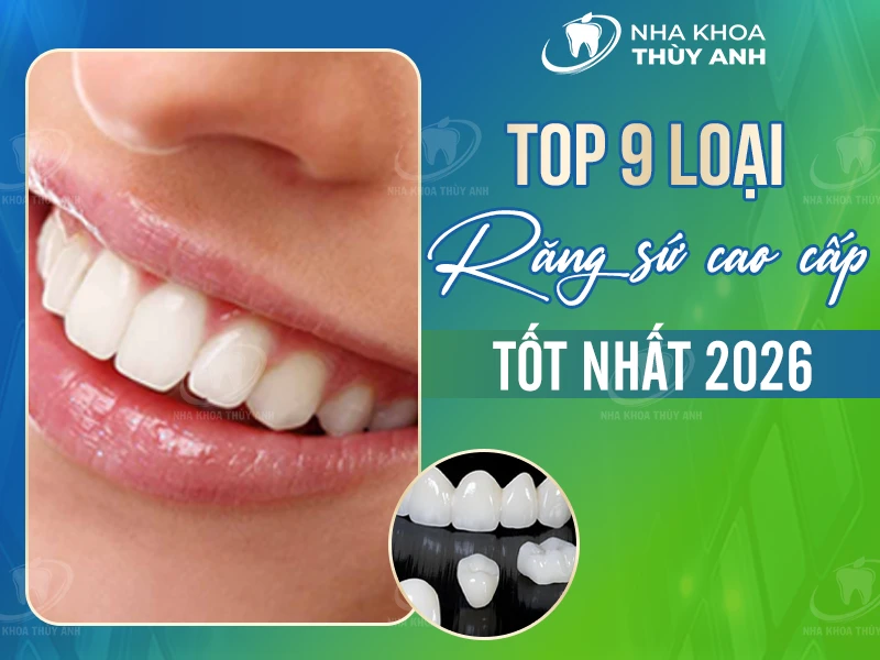 Top 9 loại răng sứ cao cấp tốt nhất 2026