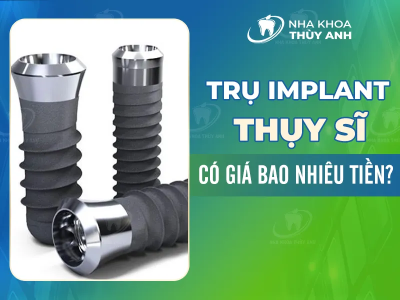 Trụ implant Thụy Sĩ có giá bao nhiêu tiền?