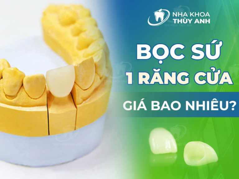 Bọc sứ 1 răng cửa được không? Giá bao nhiêu?