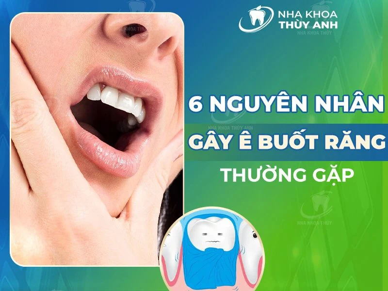 6 nguyên nhân gây ê buốt răng thường gặp