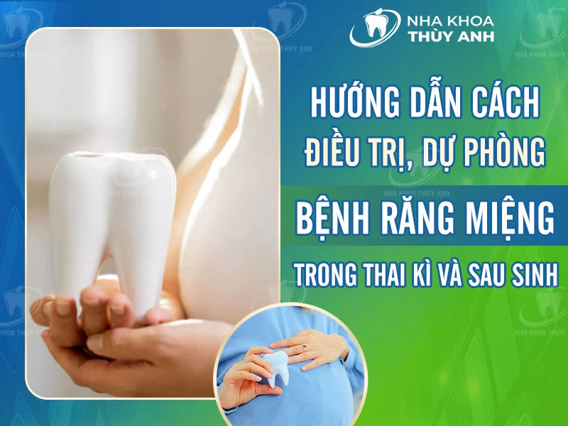 Hướng dẫn cách điều trị, dự phòng bệnh răng miệng trong thai kì và sau sinh