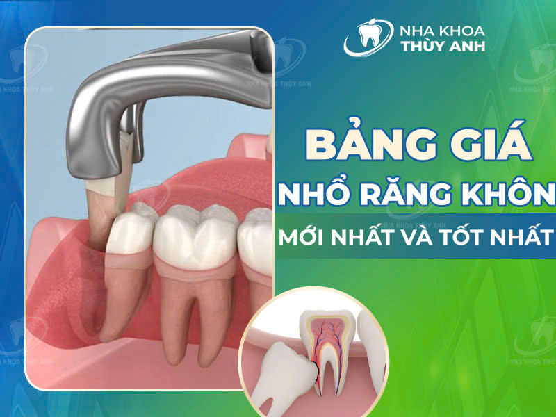 Bảng giá nhổ răng khôn mới nhất và tốt nhất năm