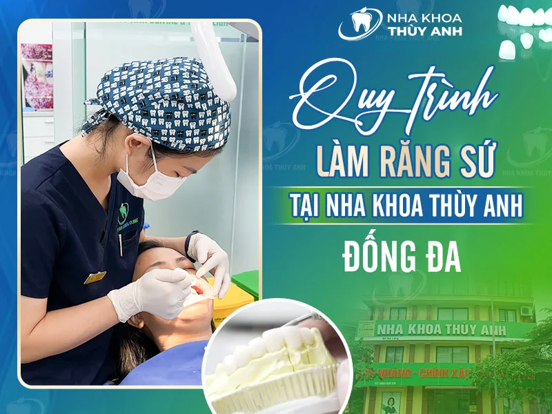 Quy trình làm răng sứ tại nha khoa Thùy Anh Đống Đa