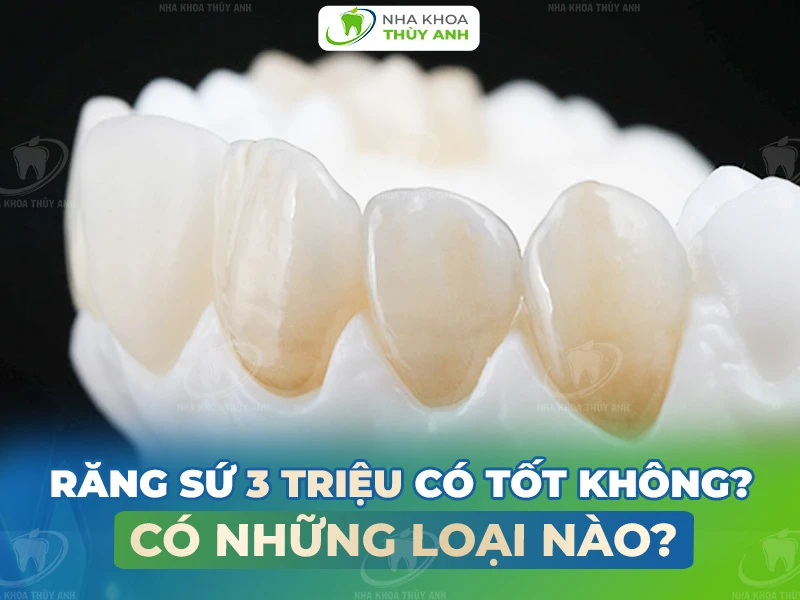 Răng sứ 3 triệu có tốt không? Có những loại nào?