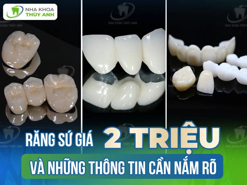 Răng sứ giá 2 triệu và những thông tin cần nắm rõ