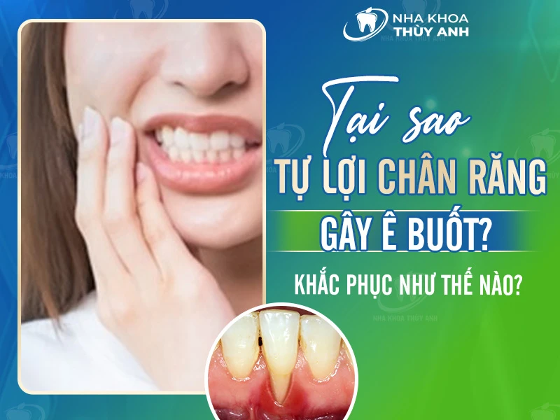 Tại sao tụt lợi chân răng gây ê buốt? Khắc phục như thế nào?