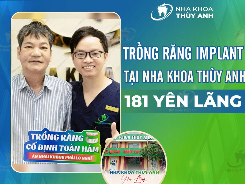 Trồng răng Implant Đống Đa tại Nha Khoa Thùy Anh Yên Lãng