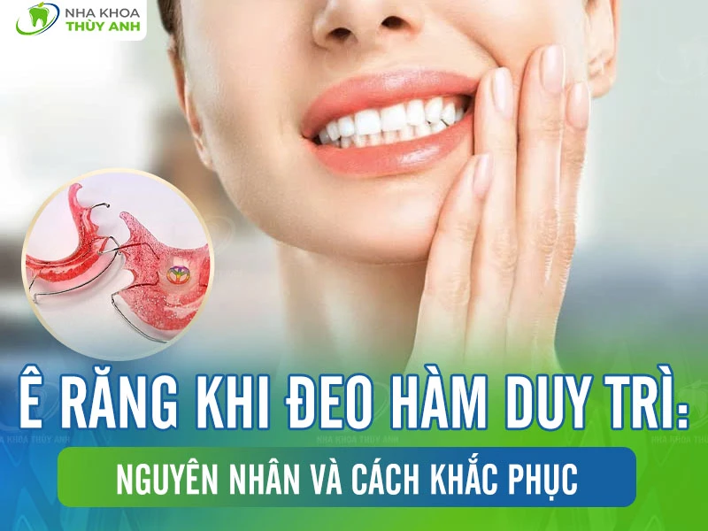 Ê răng khi đeo hàm duy trì: Nguyên nhân và cách khắc phục