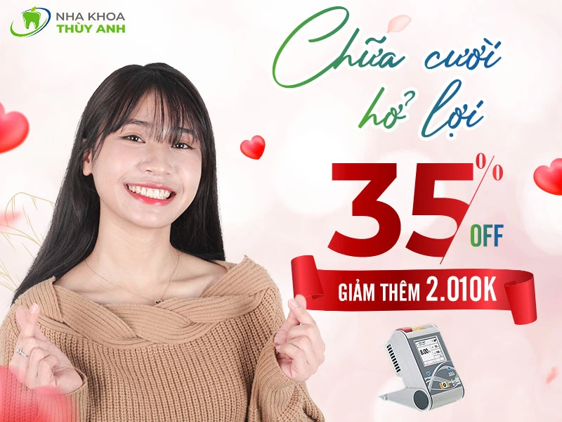 Chữa cười hở lợi giảm 50% bảo hành trọn đời