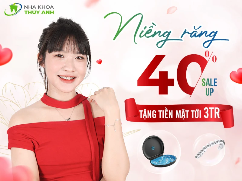 NIỀNG RĂNG ƯU ĐÃI TỚI 40% PHÍ ĐIỀU TRỊ