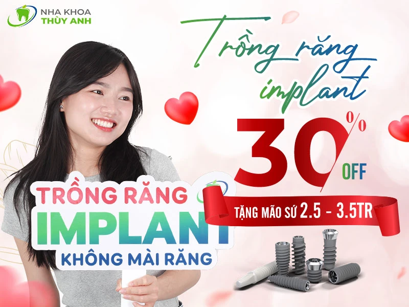 Trồng răng implant ăn ngon nhai khỏe giảm tới 30%