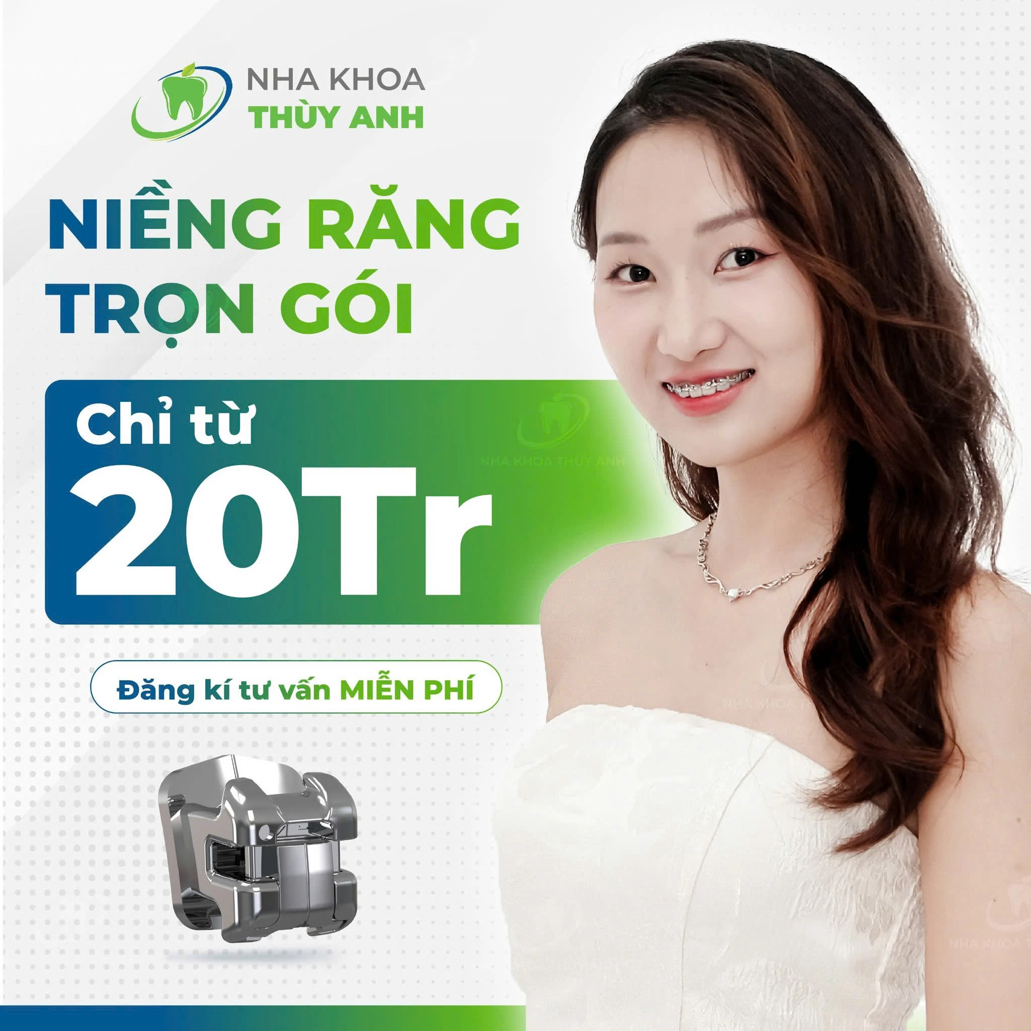 Voucher niềng răng cơ hội sở hữu nụ cười đẹp với chi phí hợp lý